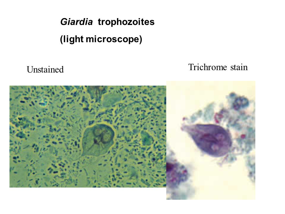 Giardiasis amebiasis Féregpete- és protozoonvizsgálat | Lab Tests Online-HU, Giardiasis amebiasis